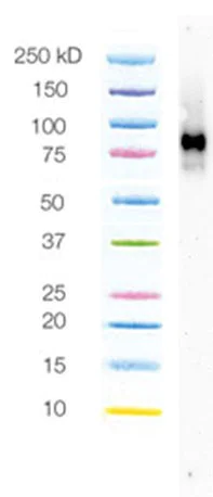Western blot - Anti-GPNMB antibody [SP299] (AB227695)