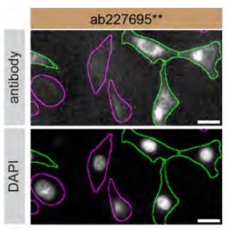Immunocytochemistry/ Immunofluorescence - Anti-GPNMB antibody [SP299] - BSA and Azide free (AB272016)