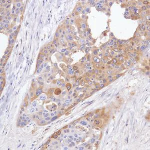 Immunohistochemistry (Formalin/PFA-fixed paraffin-embedded sections) - Anti-GPNMB antibody [SP299] - BSA and Azide free (AB272016)