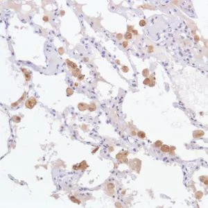 Immunohistochemistry (Formalin/PFA-fixed paraffin-embedded sections) - Anti-GPNMB antibody [SP299] - BSA and Azide free (AB272016)