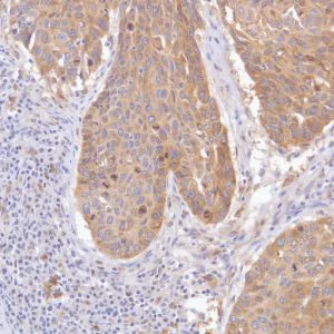Immunohistochemistry (Formalin/PFA-fixed paraffin-embedded sections) - Anti-GPNMB antibody [SP299] - BSA and Azide free (AB272016)