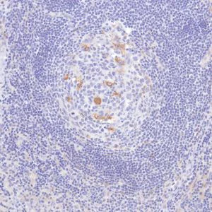 Immunohistochemistry (Formalin/PFA-fixed paraffin-embedded sections) - Anti-GPNMB antibody [SP299] - BSA and Azide free (AB272016)