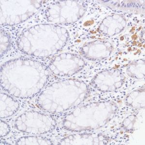Immunohistochemistry (Formalin/PFA-fixed paraffin-embedded sections) - Anti-GPNMB antibody [SP299] - BSA and Azide free (AB272016)