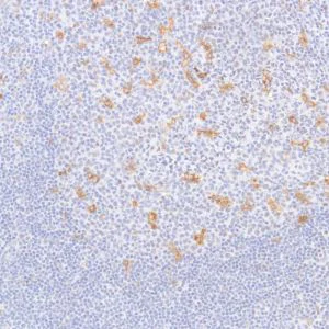 Immunohistochemistry (Formalin/PFA-fixed paraffin-embedded sections) - Anti-GPNMB antibody [SP299] - BSA and Azide free (AB272016)
