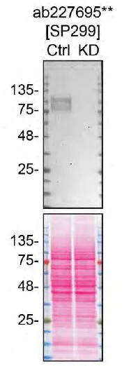 Western blot - Anti-GPNMB antibody [SP299] - BSA and Azide free (AB272016)