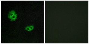 Immunocytochemistry/ Immunofluorescence - Anti-GPR171 antibody (AB189282)