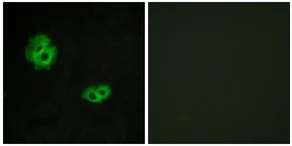 Immunocytochemistry/ Immunofluorescence - Anti-GPR171 antibody (AB189282)