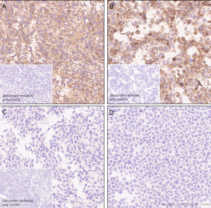 Immunohistochemistry (Formalin/PFA-fixed paraffin-embedded sections) - Anti-GPR177/WLS antibody [EPR29686-521] (ab323884), expandable thumbnail