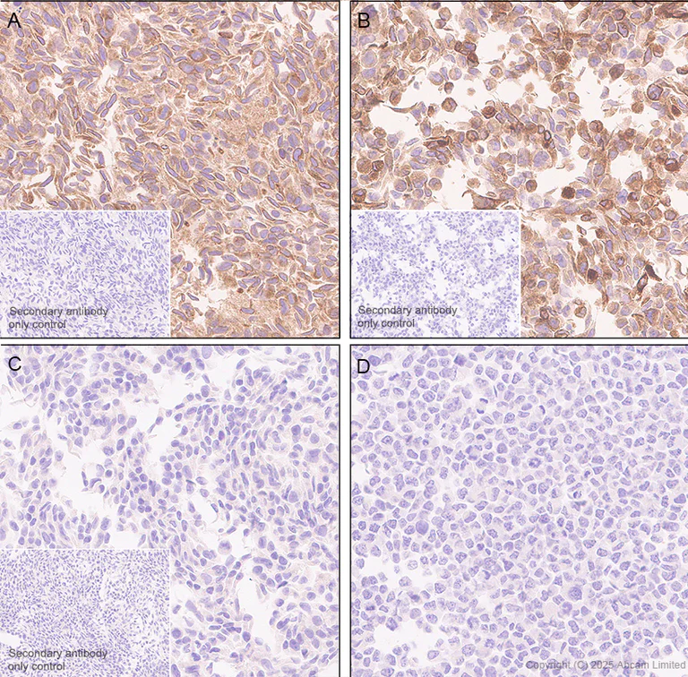 Immunohistochemistry (Formalin/PFA-fixed paraffin-embedded sections) - Anti-GPR177/WLS antibody [EPR29686-521] (AB323884)