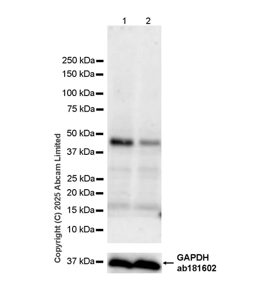 Western blot - Anti-GPR177/WLS antibody [EPR29686-521] (AB323884)