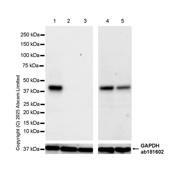 Western blot - Anti-GPR177/WLS antibody [EPR29686-569] (AB323481)