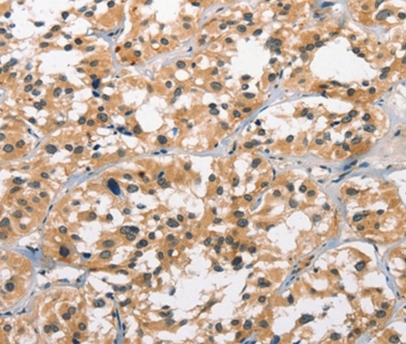 Immunohistochemistry (Formalin/PFA-fixed paraffin-embedded sections) - Anti-GPR182 antibody - Membrane Vesicle Marker (AB199177)