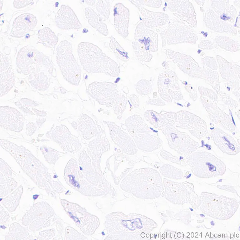 Immunohistochemistry (Formalin/PFA-fixed paraffin-embedded sections) - Anti-GPR37L1 antibody [EPR29125-35] (AB317624)