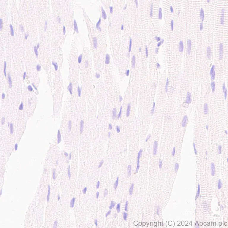 Immunohistochemistry (Formalin/PFA-fixed paraffin-embedded sections) - Anti-GPR37L1 antibody [EPR29125-35] (AB317624)