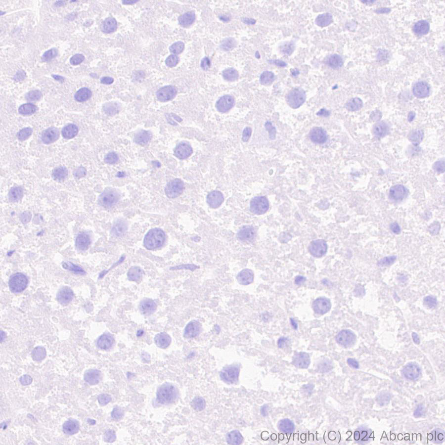 Immunohistochemistry (Formalin/PFA-fixed paraffin-embedded sections) - Anti-GPR37L1 antibody [EPR29125-35] (ab317624), expandable thumbnail