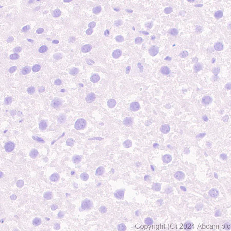 Immunohistochemistry (Formalin/PFA-fixed paraffin-embedded sections) - Anti-GPR37L1 antibody [EPR29125-35] (AB317624)