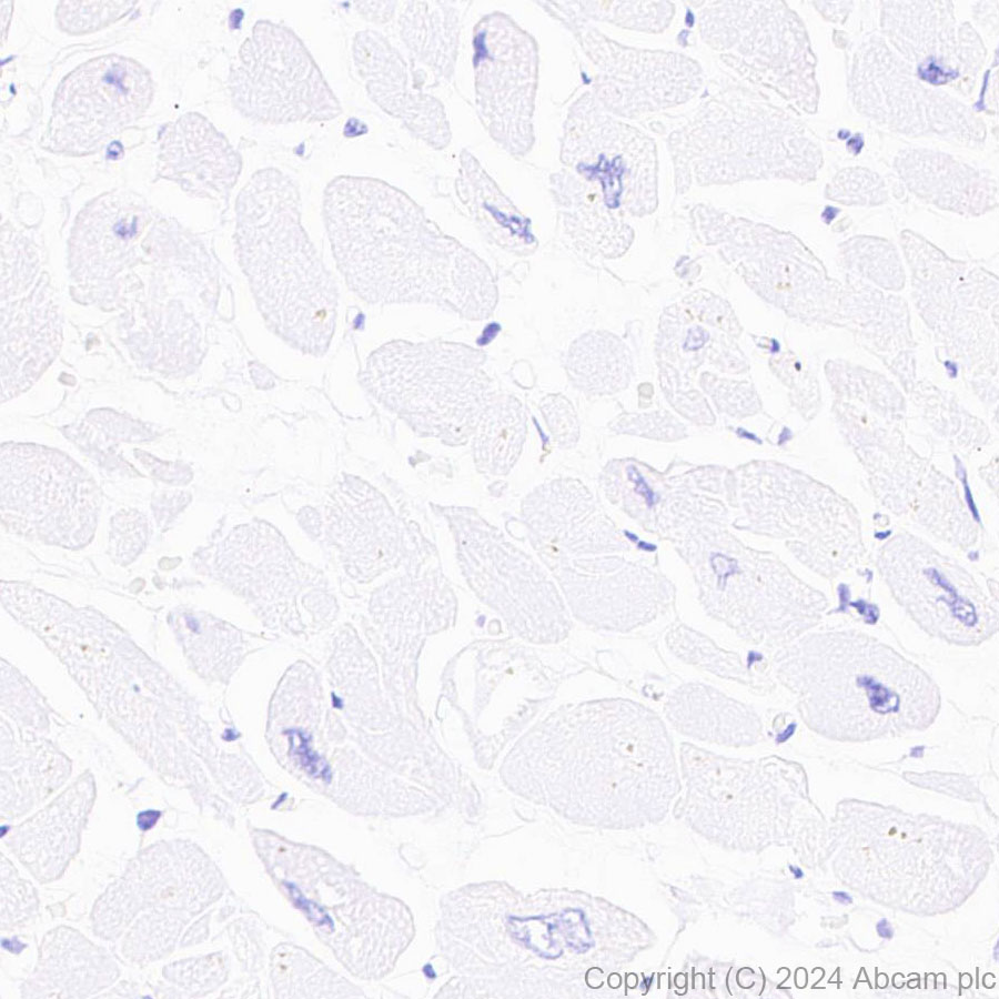 Immunohistochemistry (Formalin/PFA-fixed paraffin-embedded sections) - Anti-GPR37L1 antibody [EPR29125-35] - BSA and Azide free (ab317625), expandable thumbnail