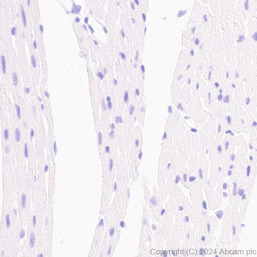 Immunohistochemistry (Formalin/PFA-fixed paraffin-embedded sections) - Anti-GPR37L1 antibody [EPR29125-35] - BSA and Azide free (ab317625), expandable thumbnail