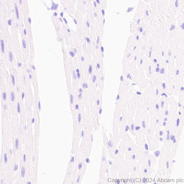 Immunohistochemistry (Formalin/PFA-fixed paraffin-embedded sections) - Anti-GPR37L1 antibody [EPR29125-35] - BSA and Azide free (AB317625)