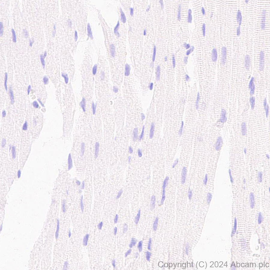 Immunohistochemistry (Formalin/PFA-fixed paraffin-embedded sections) - Anti-GPR37L1 antibody [EPR29125-35] - BSA and Azide free (ab317625), expandable thumbnail