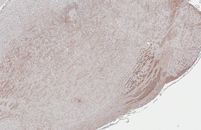 Immunohistochemistry (Formalin/PFA-fixed paraffin-embedded sections) - Anti-GPR40 antibody [HL3956] - BSA and Azide free (AB327627)