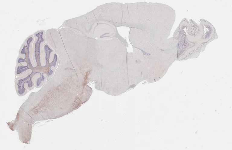 Immunohistochemistry (Formalin/PFA-fixed paraffin-embedded sections) - Anti-GPR40 antibody [HL3956] - BSA and Azide free (AB327627)