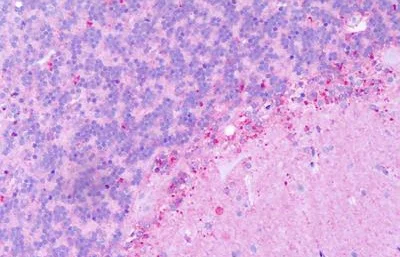 Immunohistochemistry (Formalin/PFA-fixed paraffin-embedded sections) - Anti-GPR54 antibody - C-terminal (AB188995)