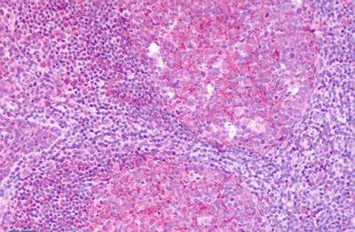 Immunohistochemistry (Formalin/PFA-fixed paraffin-embedded sections) - Anti-GPR54 antibody - C-terminal (AB188995)