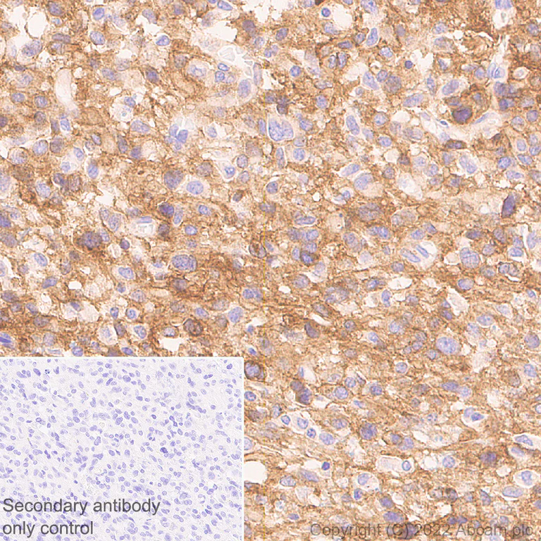 Immunohistochemistry - Anti-GPR56 antibody [EPR26546-78] - BSA and Azide free (AB302910)