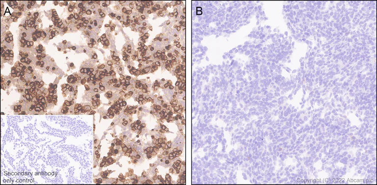 Immunohistochemistry - Anti-GPR56 antibody [EPR26546-78] - BSA and Azide free (AB302910)