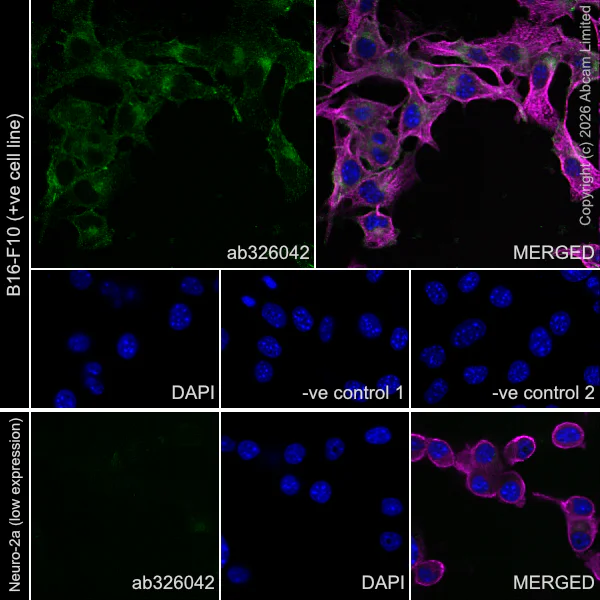 Immunocytochemistry/ Immunofluorescence - Anti-GPR56 antibody [RM2094] (AB326042)