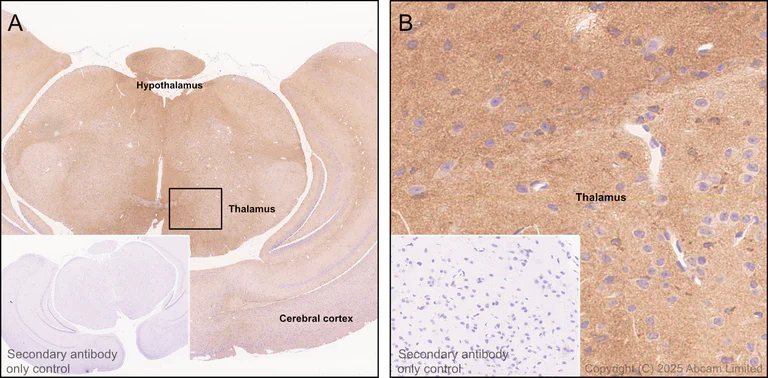Immunohistochemistry (Formalin/PFA-fixed paraffin-embedded sections) - Anti-GPR56 antibody [RM2094] (AB326042)