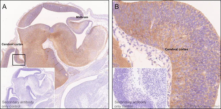 Immunohistochemistry (Formalin/PFA-fixed paraffin-embedded sections) - Anti-GPR56 antibody [RM2094] (AB326042)