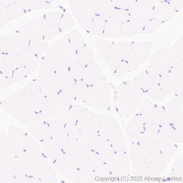 Immunohistochemistry (Formalin/PFA-fixed paraffin-embedded sections) - Anti-GPR56 antibody [RM2094] (AB326042)
