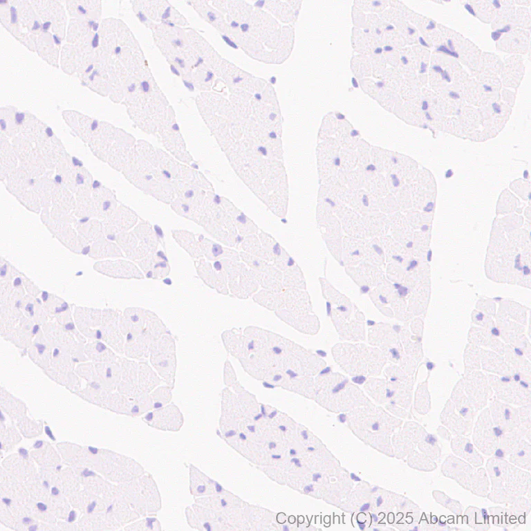 Immunohistochemistry (Formalin/PFA-fixed paraffin-embedded sections) - Anti-GPR56 antibody [RM2094] (AB326042)