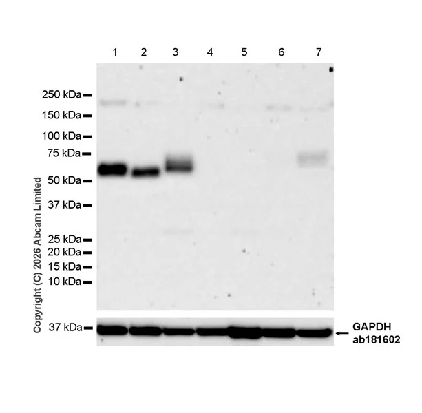 Western blot - Anti-GPR56 antibody [RM2094] (AB326042)