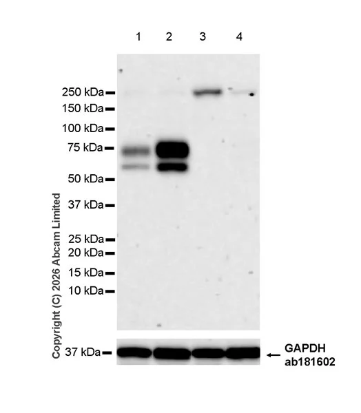 Western blot - Anti-GPR56 antibody [RM2094] (AB326042)