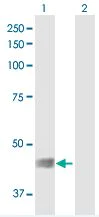 Western blot - Anti-GPR61 antibody (AB169136)