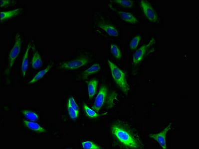 Immunocytochemistry/ Immunofluorescence - Anti-GPR83 antibody (AB237610)