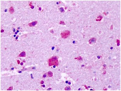 Immunohistochemistry (Formalin/PFA-fixed paraffin-embedded sections) - Anti-GPR83 antibody - Extracellular domain (AB140767)