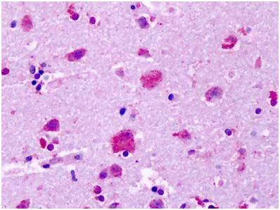 Immunohistochemistry (Formalin/PFA-fixed paraffin-embedded sections) - Anti-GPR83 antibody - Extracellular domain (AB140767)