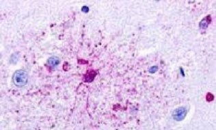 Immunohistochemistry (Formalin/PFA-fixed paraffin-embedded sections) - Anti-GPR84 antibody (AB188786)