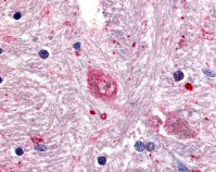 Immunohistochemistry (Formalin/PFA-fixed paraffin-embedded sections) - Anti-GPR88 antibody (AB64905)