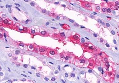 Immunohistochemistry (Formalin/PFA-fixed paraffin-embedded sections) - Anti-GPR91 antibody - Cytoplasmic domain (AB140795)