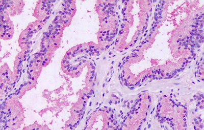 Immunohistochemistry (Formalin/PFA-fixed paraffin-embedded sections) - Anti-GPRC5A antibody - Extracellular domain (AB188905), expandable thumbnail