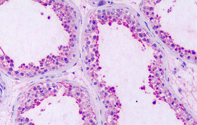 Immunohistochemistry (Formalin/PFA-fixed paraffin-embedded sections) - Anti-GPRC5A antibody - Extracellular domain (AB188905), expandable thumbnail