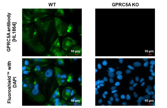 Immunocytochemistry/ Immunofluorescence - Anti-GPRC5A antibody [HL1864] - BSA and Azide free (AB325861)