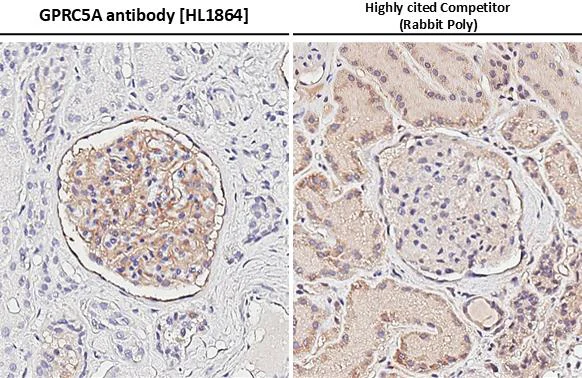 Immunohistochemistry (Formalin/PFA-fixed paraffin-embedded sections) - Anti-GPRC5A antibody [HL1864] - BSA and Azide free (AB325861)