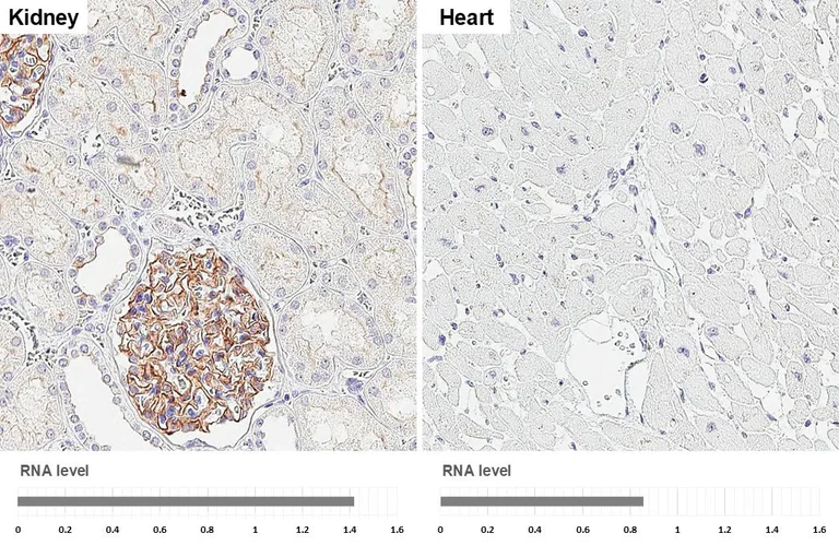 Immunohistochemistry (Formalin/PFA-fixed paraffin-embedded sections) - Anti-GPRC5A antibody [HL1864] - BSA and Azide free (AB325861)