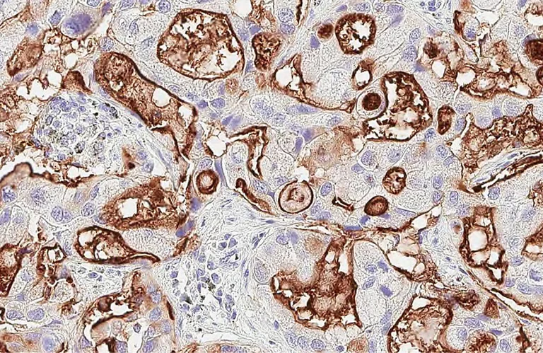 Immunohistochemistry (Formalin/PFA-fixed paraffin-embedded sections) - Anti-GPRC5A antibody [HL1864] - BSA and Azide free (AB325861)